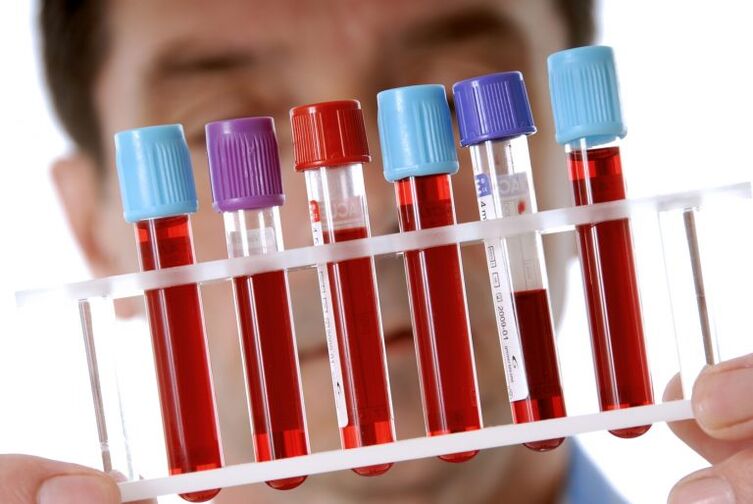 Blood tests for the diagnosis of helminthiases